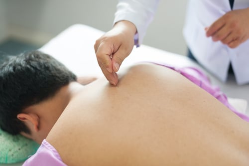 Acupuncture As A Remedy for Back Pain